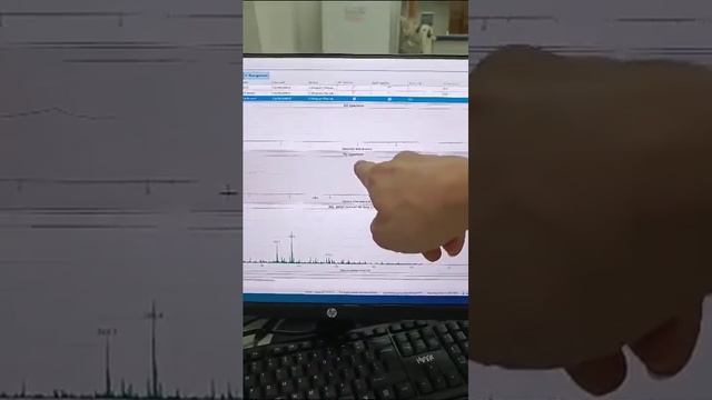 Хромато-масс спектрометр Skyray LCMS-2000 от компании Радоника Www.radonika.com