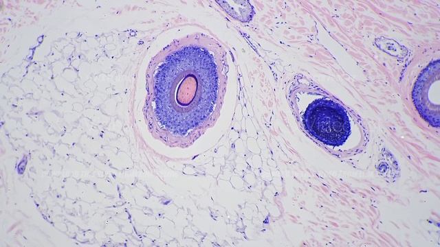 Human skin shown with hair follicles in section under microscope with 100x times magnification смотреть онлайн