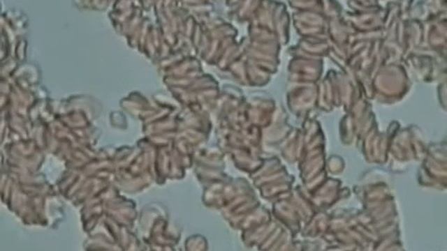 уникальные кадрытемнопольный микроскоп