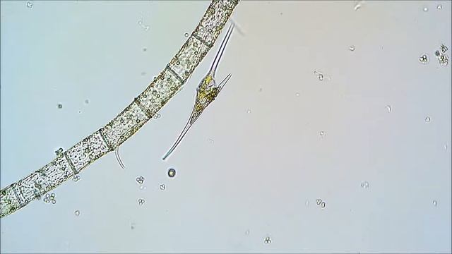 Жгутиконосец Цератиум (Flagellate Ceratium) смотреть онлайн