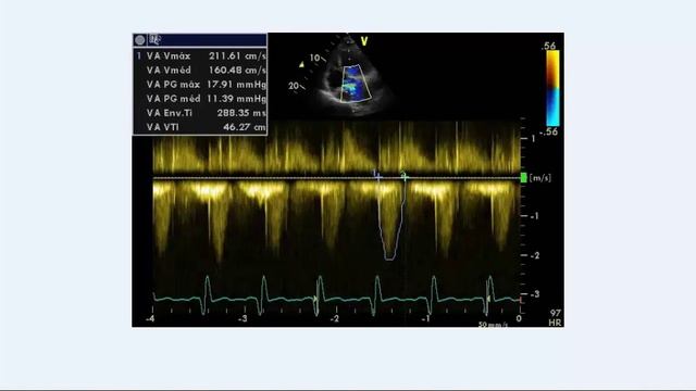 Sessão Cardiologia смотреть онлайн