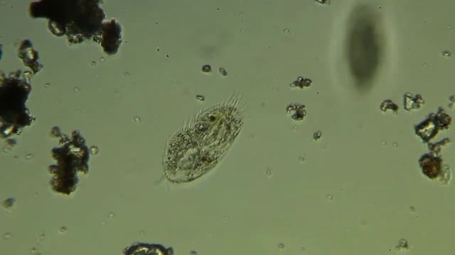Инфузория. Paramecia смотреть онлайн