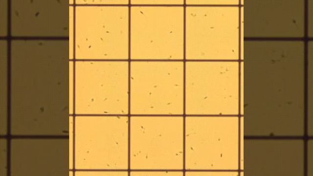 Looking through a microscope: ejaculate (semen)