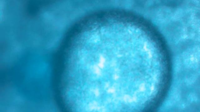 содовая среда (4 дня тестам) смотреть онлайн