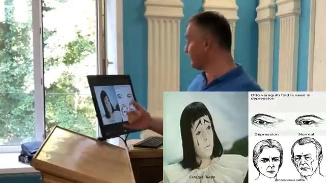 Патология эмоций и воли смотреть онлайн