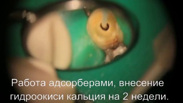 Рабочие будни с использованием операционного микроскопа