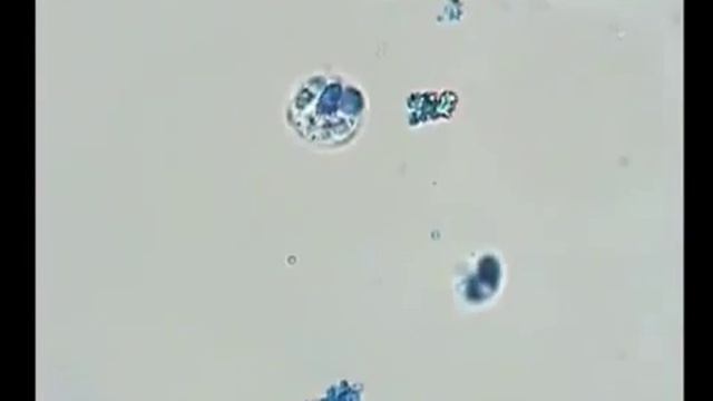 Третье воздействие прибором  Практически все микроорганизмы неподвижны, т е  нежизнеспособны