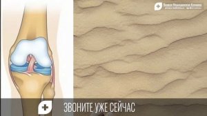 Деформирующий артроз: симптомы и методы лечения
