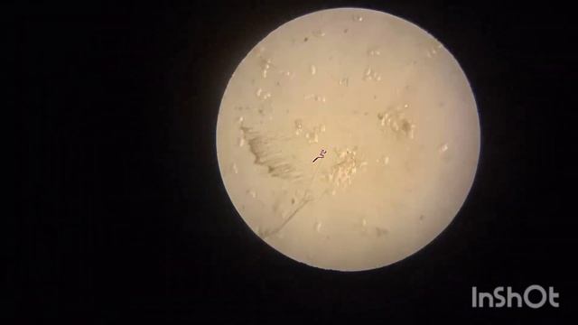 Бактерии под микроскопом.