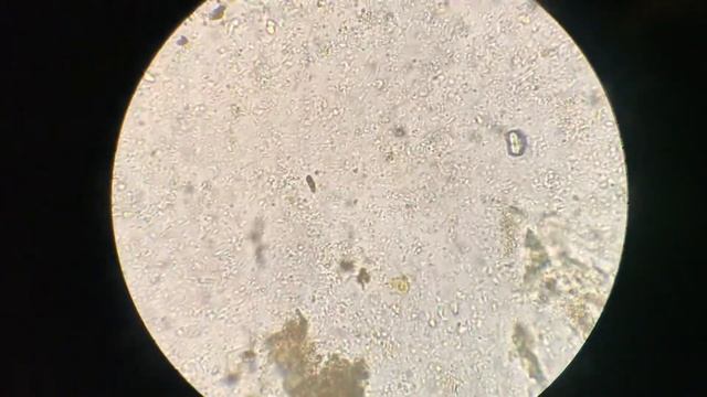 Trichomonas Under Microscope From Chlamydotis Undulata (Houbara Bustard) In Uzbekistan