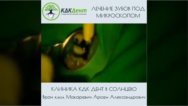 Как проходит лечение зубов под микроскопом ?