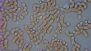 «Пьяная» и «трезвая» кровь под микроскопом