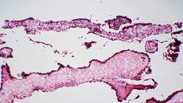 Lichen Section Under Microscope 100x For Educational Issues And Experiments On Bright Field