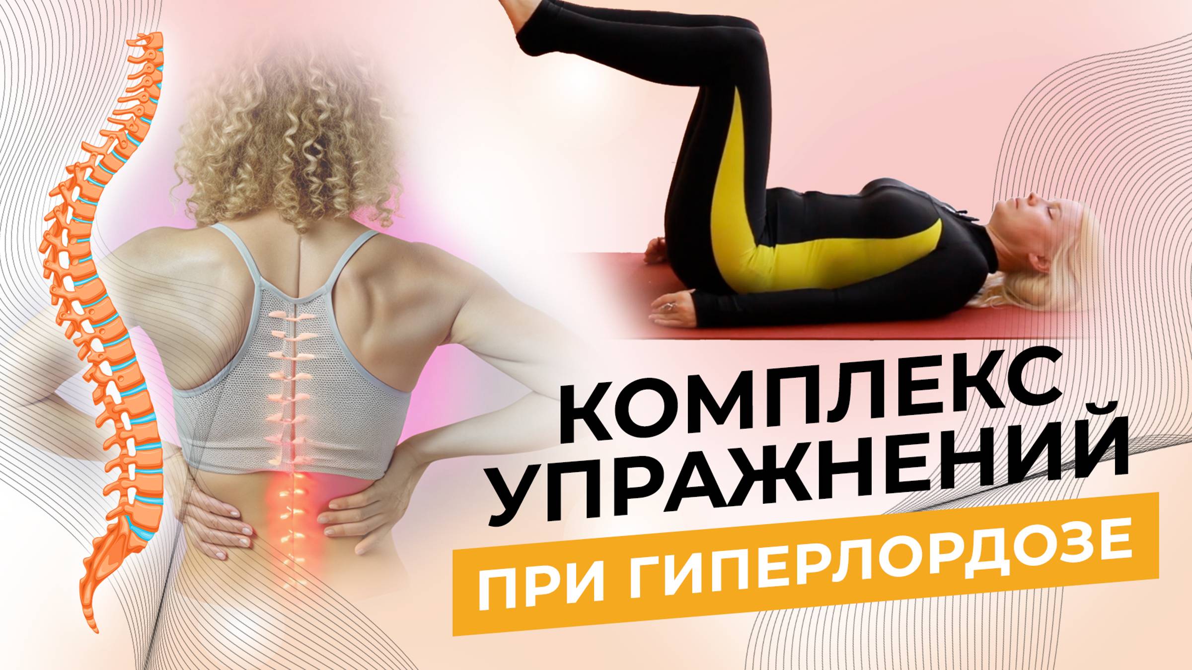 Комплекс упражнений при ГИПЕРЛОРДОЗЕ смотреть онлайн