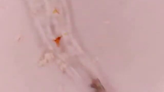 Личинка креветки амано под микроскопом