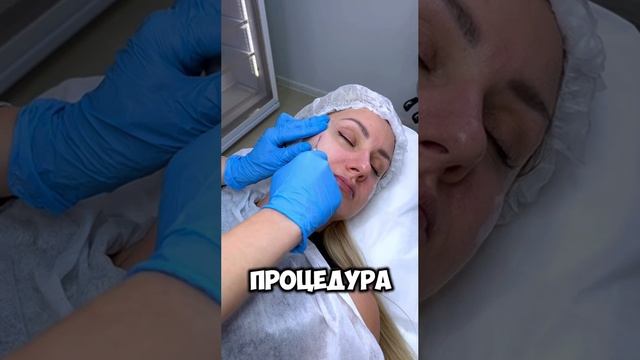 Процедура Radiesse. Что опять? смотреть онлайн