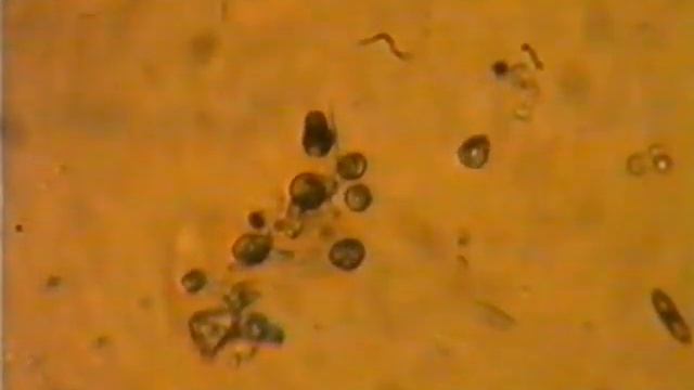 1998 год Видеозапись через микроскоп смотреть онлайн