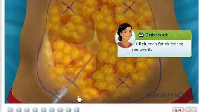 Surgery Game #1 FUCKING EWW