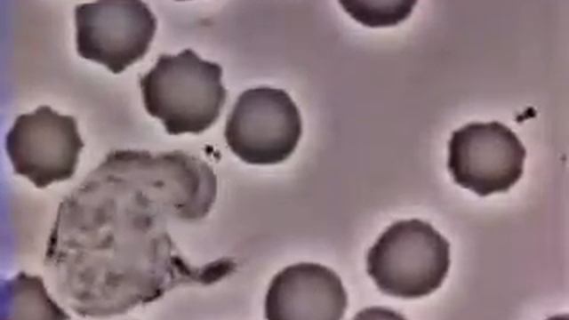 Лейкоцит охотиться на бактерию реал с микроскопа WMV V9 смотреть онлайн
