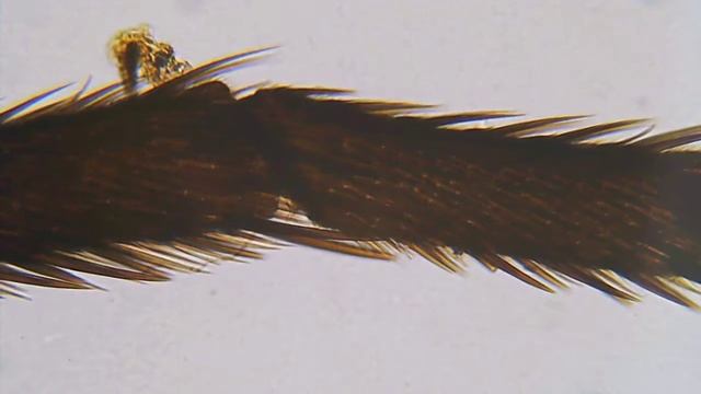 Légy Láb / Fly Legs