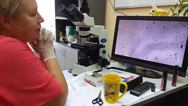 Как выглядят спреи Alivemax под микроскопом.