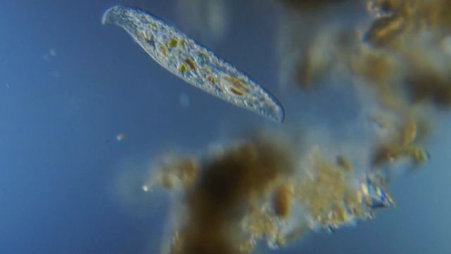 Неизвестная инфузрия