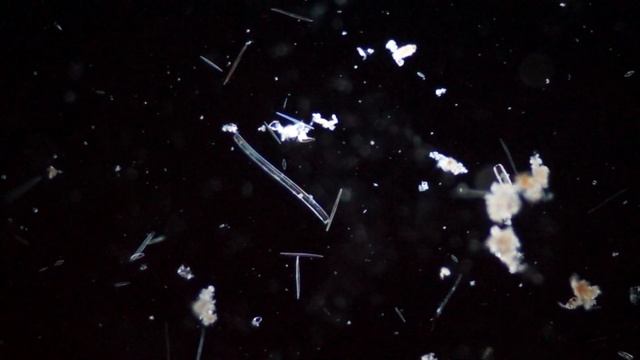 Движение диатомовых водорослей, темное поле ОИ-10.