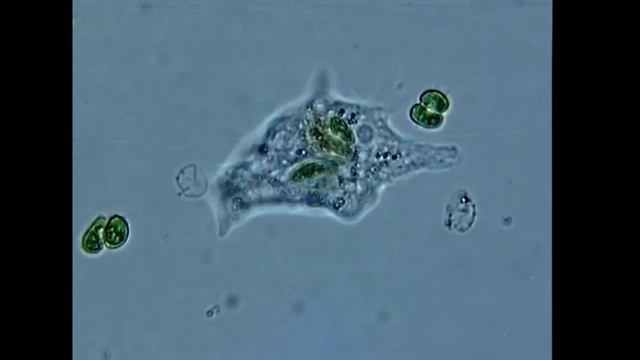"In the Clutches of DEATH" Amoeba in brightfield 3 смотреть онлайн