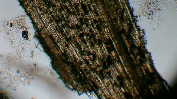 Ил под микроскопом. Activated sludge under the microscope