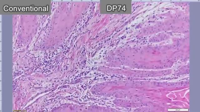 Olympus DP74 Microscope Camera   Frame Rate Comparison1