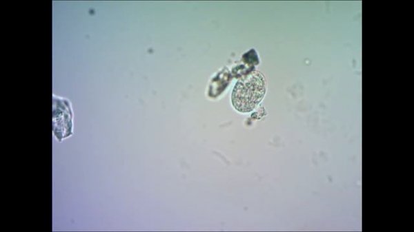 ??? под микроскопом under microscope