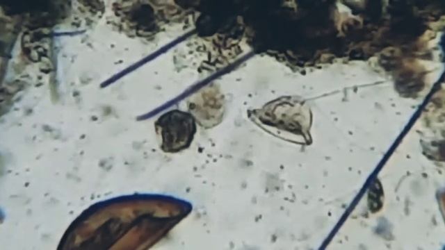 ЧТО ОБИТАЕТ КАПЛЕ ВОДЫ