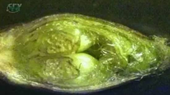 Почка. Строение почек смотреть онлайн