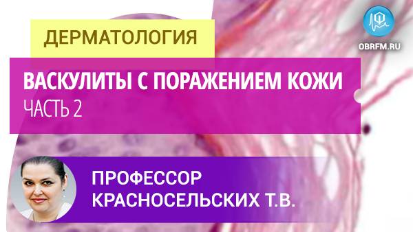 Васкулиты с поражением кожи. Часть 2 смотреть онлайн