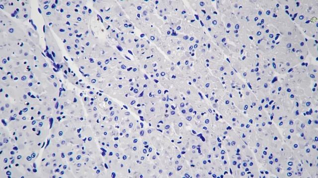 Microscope 400x Of Cardiac Muscle In Section Filmed On Bright Field Background