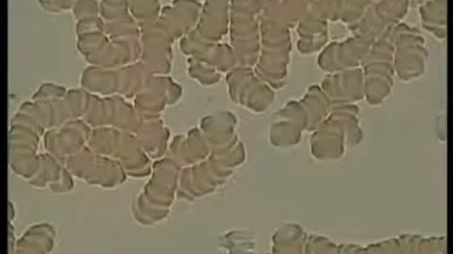 Что можно увидеть в крови