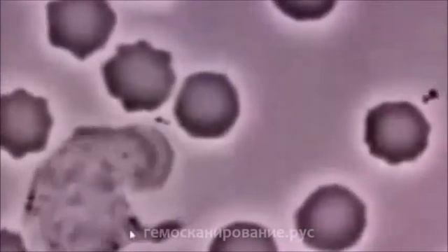 Охотящийся лейкоцит