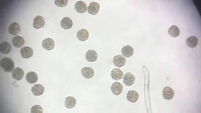 Larva Bulu Babi Atau Disebut TIR (Echinodae)  H1 Pada Mikroskop  10 X Di Lab Chrisma Ohoi Sathean