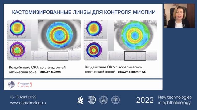 Секция «Актуальные вопросы детской офтальмологии» смотреть онлайн