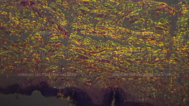Sweat glands on human skin filmed under microscope 100x with cross light смотреть онлайн