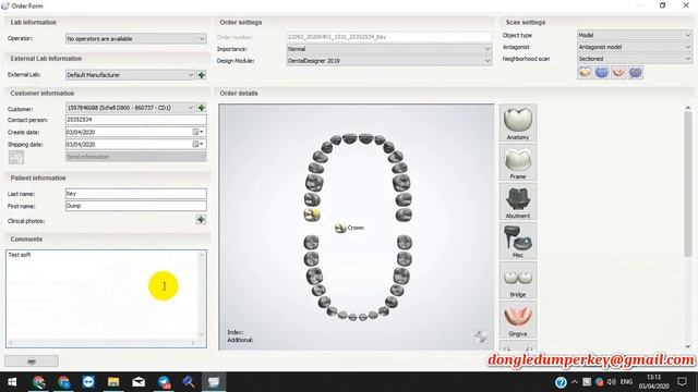 3Shape Dental System Dinkey backup solution by Key Dump Team смотреть онлайн