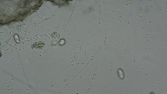 DSC 8627 Вода под микроскопом смотреть онлайн