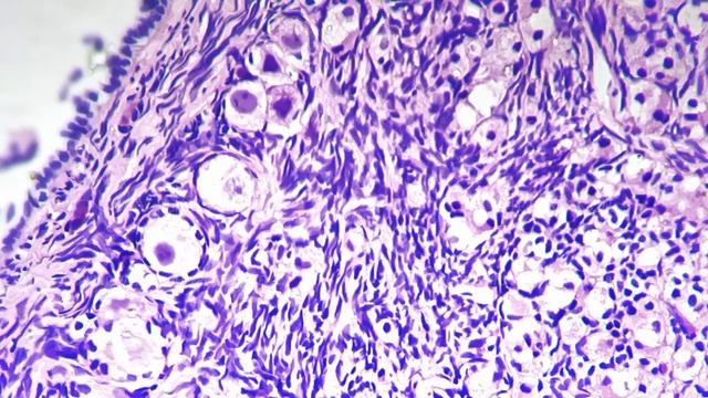 Ovary in section magnified under microscope 400x against bright field смотреть онлайн