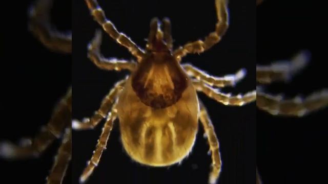 Tick under the Microscope смотреть онлайн