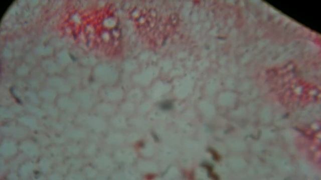 Разные растения и кусочки насекомых под микроскопом