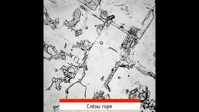 НЕВЕРОЯТНЫЕ СНИМКИ СЛЁЗ ПОД МИКРОСКОПОМ! смотреть онлайн