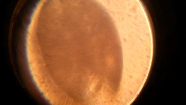 120115 Остракода (Ostracoda) 450x смотреть онлайн