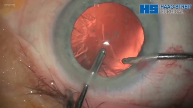 Хирургический микроскоп Haag-Streit Surgical ALLEGRA 900 смотреть онлайн
