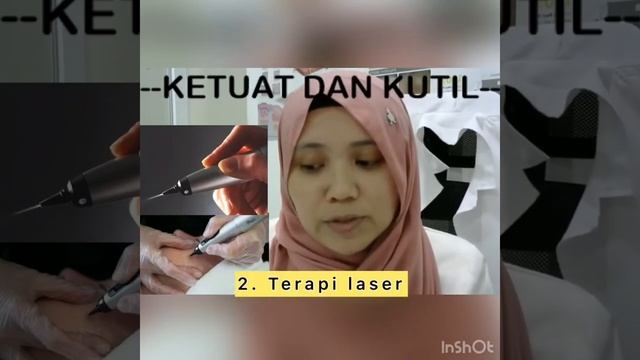 Skin Tag (Kutil) & Warts (Ketuat)