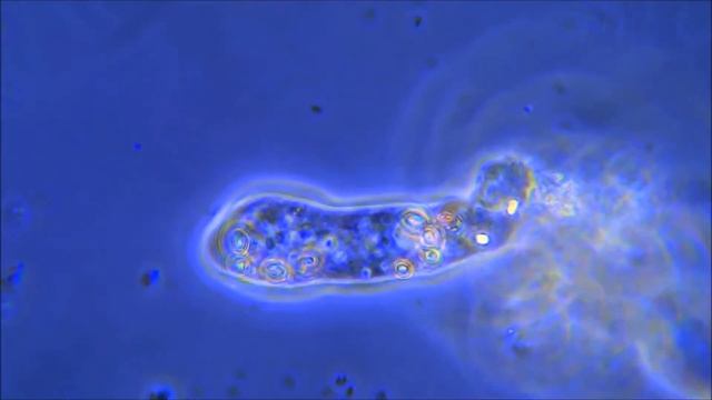 Амёба. Фазовый контраст. Amoeba. Phase Contrast.